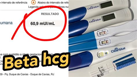 resultado beta hcg 2 0 mui/ml que significa - Resultado beta HCG 2.2 mui/ml: O que significa? 